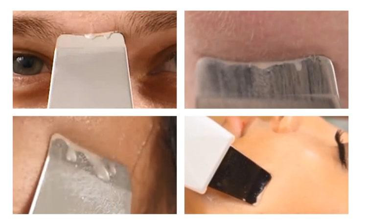 Скрабер для чистки и подтяжки лица ультразвуковой портативный+ Ионизация+ Антибактериальная терапия+ Сонофорез Днепр - изображение 2