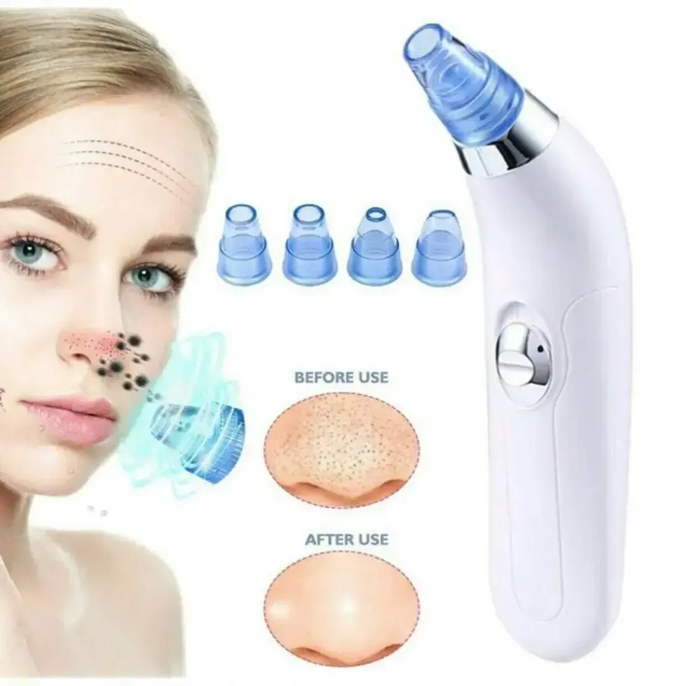 Вакуумный очиститель Derma suction DS Vacuum для профессиональной чистки кожи и пор лица - легкий компактный удобный прибор в использовании + 4 насадк Коломия - фото 6
