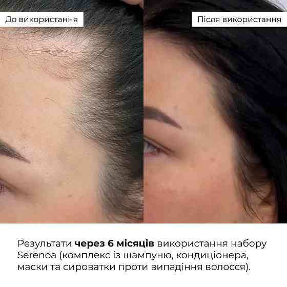 Маска против выпадения волос Hillary Serenoa & РР Hair Loss Control Mask, 200 мл Киев
