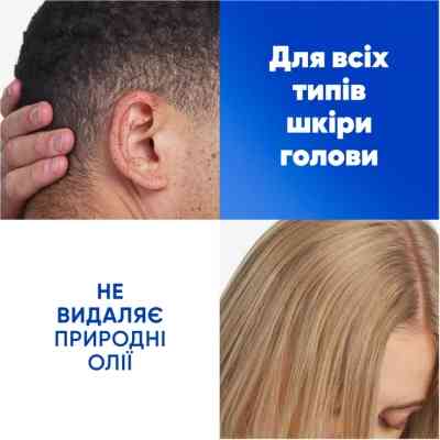 Шампунь Head &amp; Shoulders Яблучна свіжість 400 мл (5410076659456) Вінниця