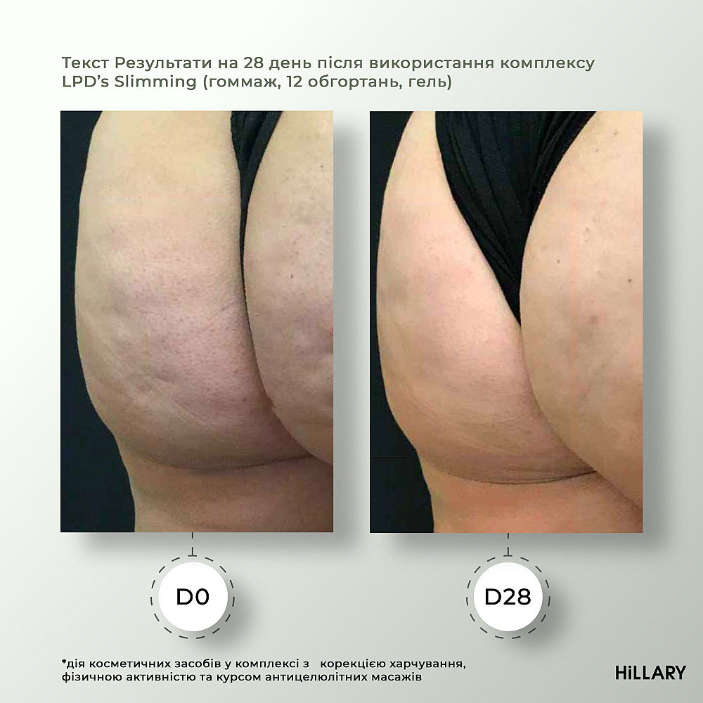 Набір Антицелюлітні ліпосомальні обгортання + рідина Anti-cellulite LPD'S Slimming (6 процедур) Hillary Київ - фото 9