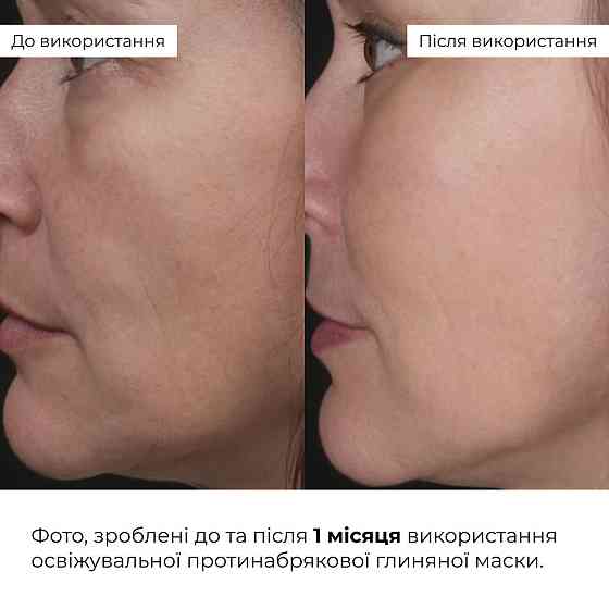 Освіжувальна протинабрякова глиняна маска Hillary Revive & Refresh Clay Mask, 90 мл Київ