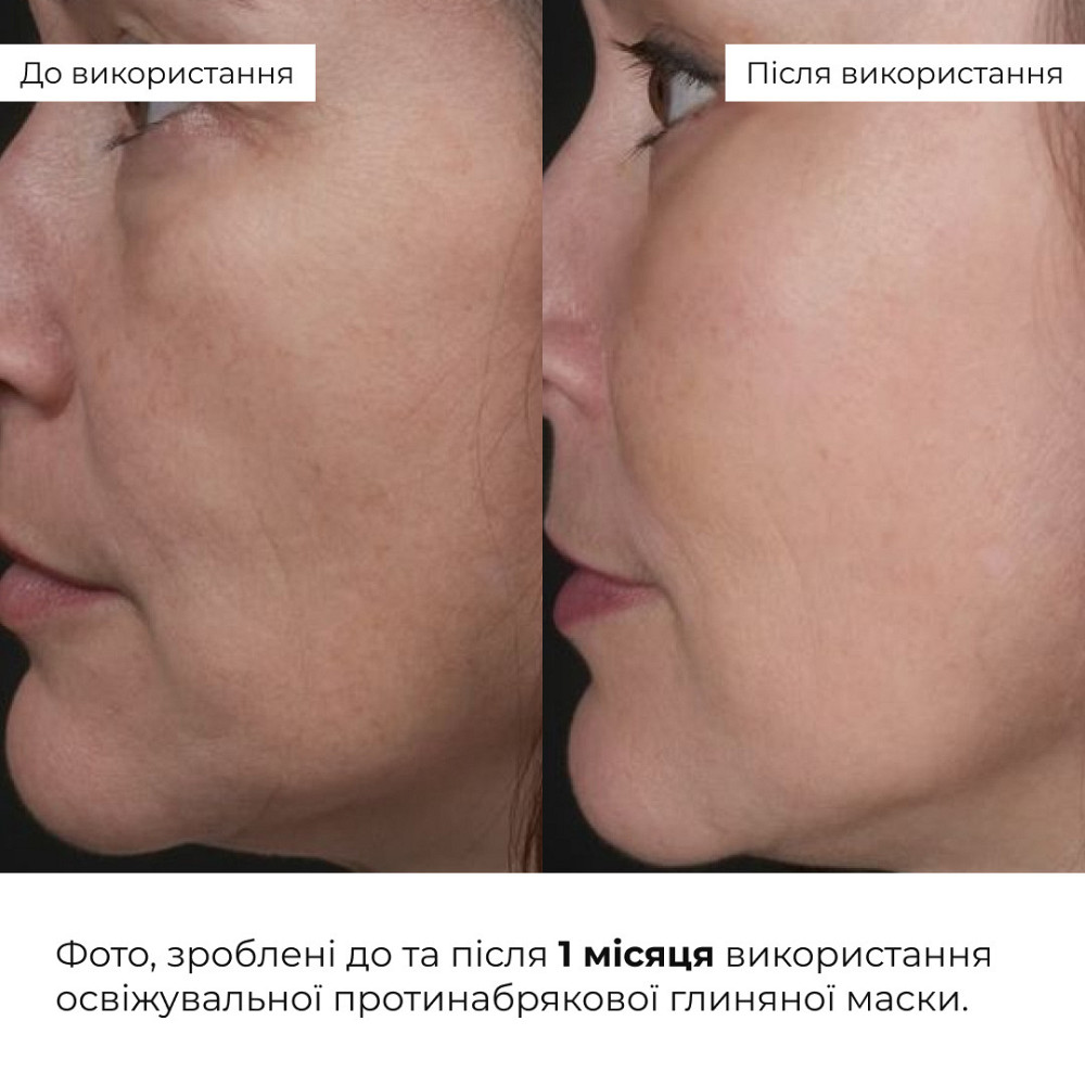 Освіжувальна протинабрякова глиняна маска Hillary Revive & Refresh Clay Mask, 90 мл Київ - фото 2