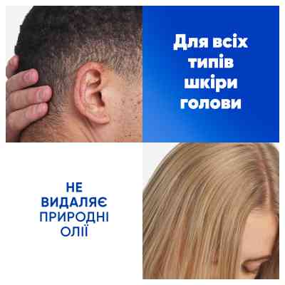 Шампунь Head & Shoulders Яблочная свежесть 250 мл (8006540063248) Винница