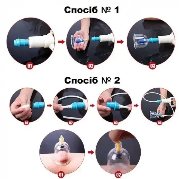 Массажные антицеллюлитные вакуумные банки 32 шт JINKANG с вакуумным насосом Коломия - фото 3