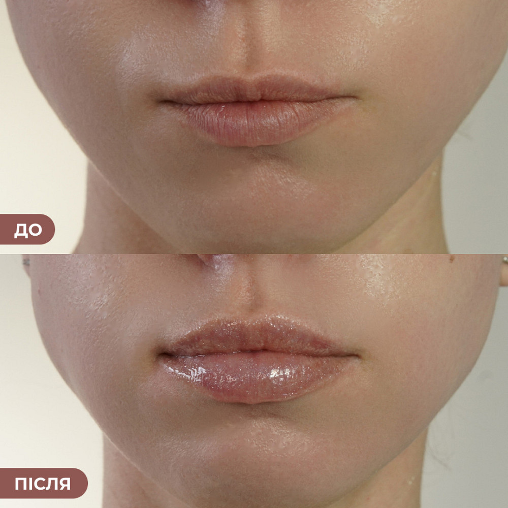 Набор против трещин и для увлажнения губ Hillary Lip Repair & Hydration Set Киев - изображение 2