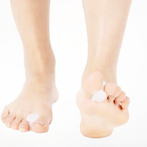 Межпальцевая перегородка для пальців ніг - Ersamed SL-503 Днепр - изображение 3