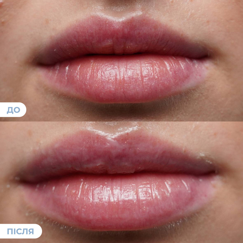 Набор блесков для интенсивного увлажнения и сияющих губ Hillary Deep Hydration & Radiance Lip Trio Киев - изображение 4