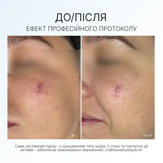 Судинозміцнююча сироватка ANTI-REDNESS SERUM AG Skin 30 мл Дніпро