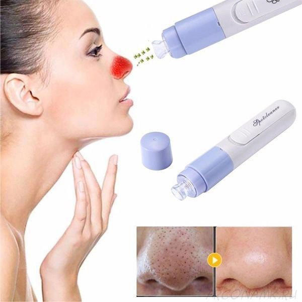 Вакуумный очиститель SPOTCLEANER Face Pore Cleaner вакуумный очиститель пор лица JG-74 Львов - изображение 10