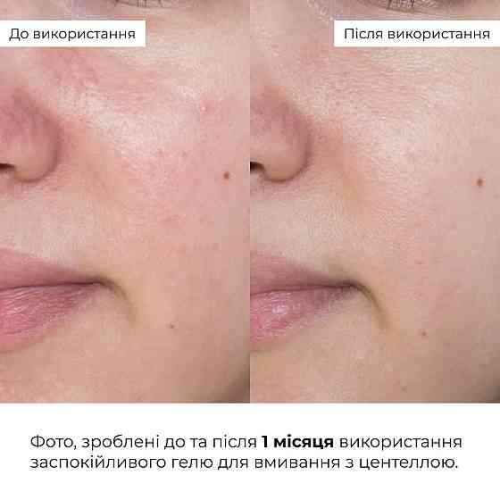 Набор для успокоения и увлажнения кожи с центеллой Hillary Centella Calm & Hydrate Set Киев