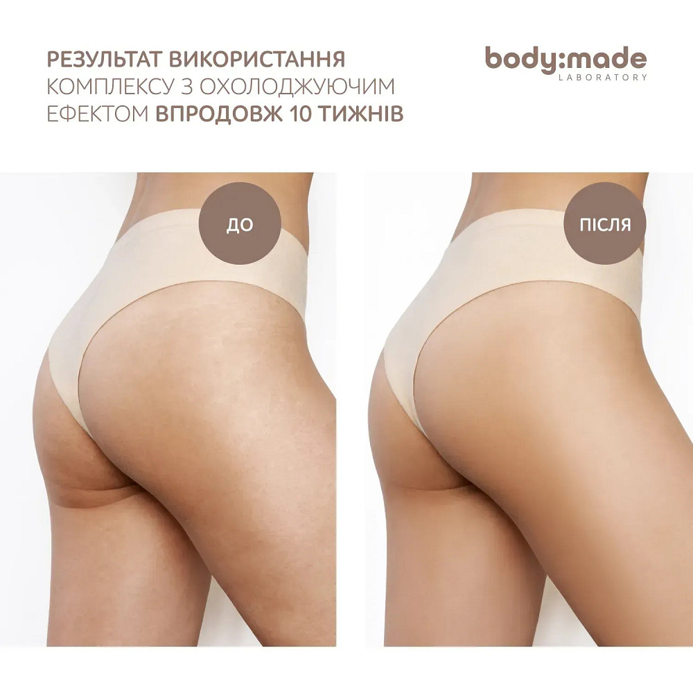 Крем-гель с антицеллюлитным эффектом моделирующий BodyMade 200 мл Киев - изображение 7