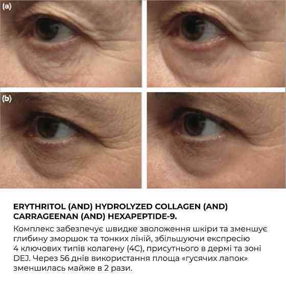 Комплекс щоденного антивікового догляду ReNuAge Daily Anti-Aging Care Complex Hillary Вінниця