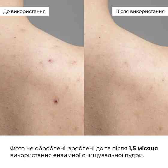 Набір ніжного очищення та глибокого живлення для сухої та чутливої шкіри Hillary for dry and sensitive skin Киев