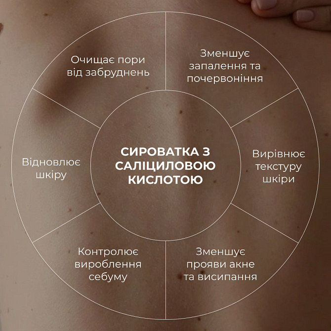 Сироватка для проблемної шкіри з саліциловою кислотою Back & Body Acne Control serum Hillary 50 мл Вінниця - фото 9