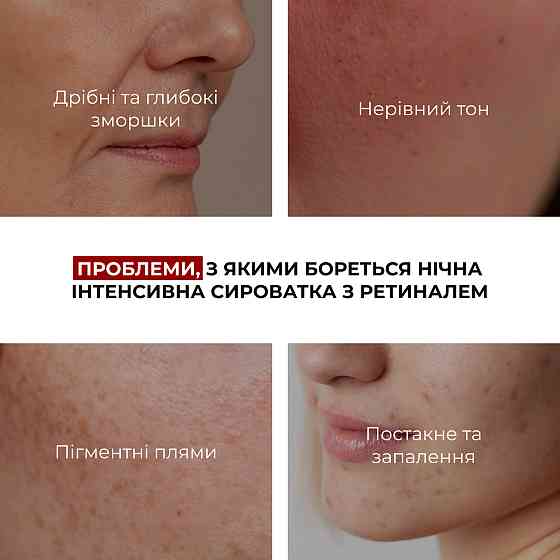 Нічна інтенсивна сироватка з ретиналем Night Intense Retinal Serum Hillary 30 мл Київ