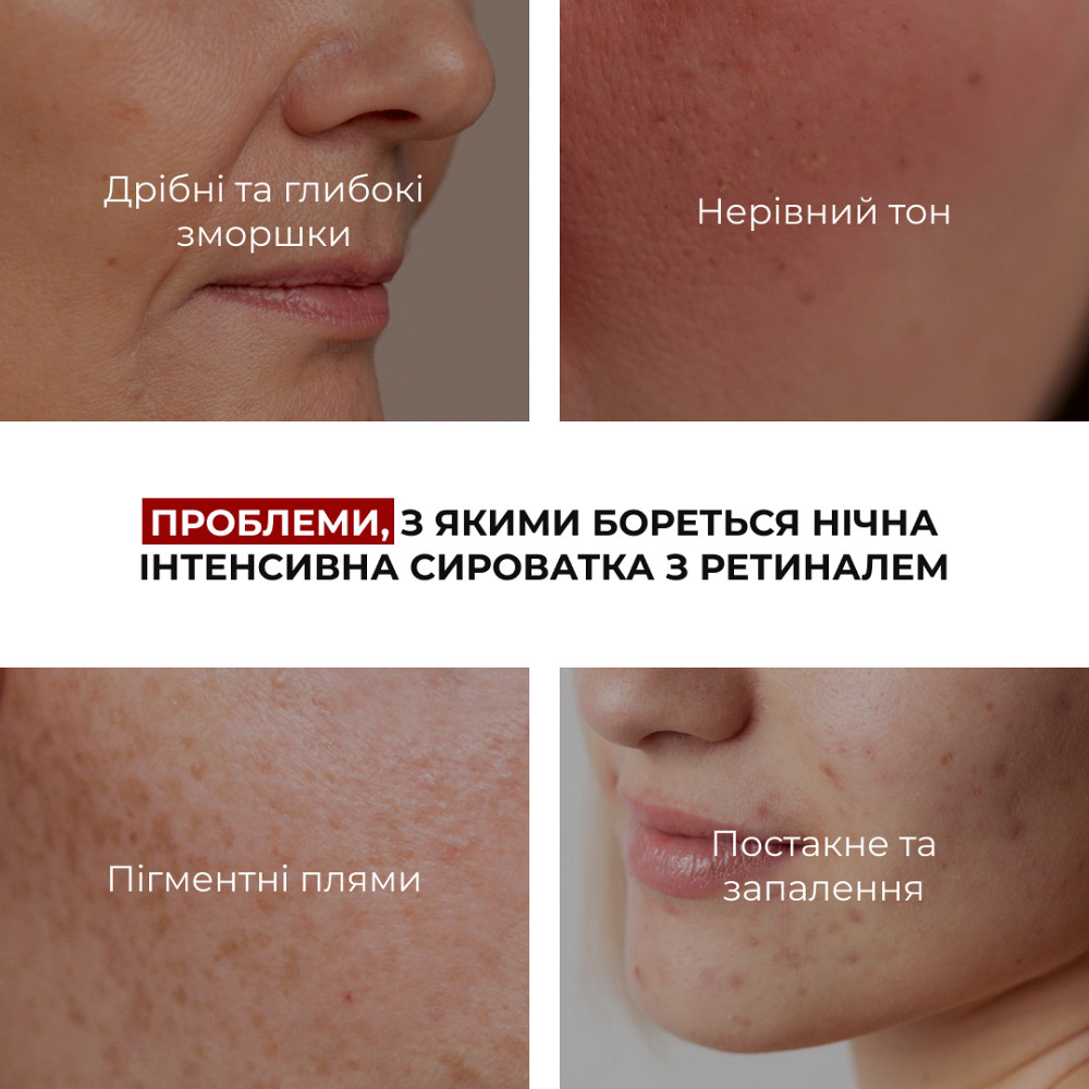 Нічна інтенсивна сироватка з ретиналем Night Intense Retinal Serum Hillary 30 мл Київ - фото 6