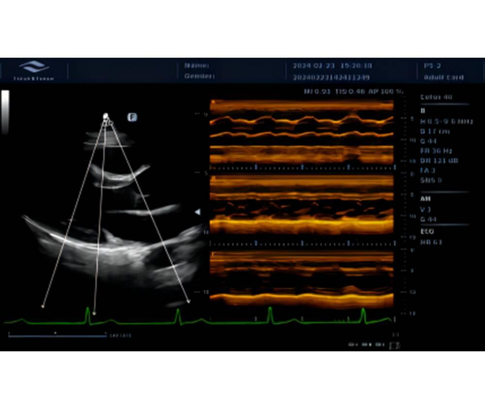 Ультразвукова діагностична система стаціонарна експертного класу +2 датчики Cetus 40 Focus & Fusion Дніпро - фото 6
