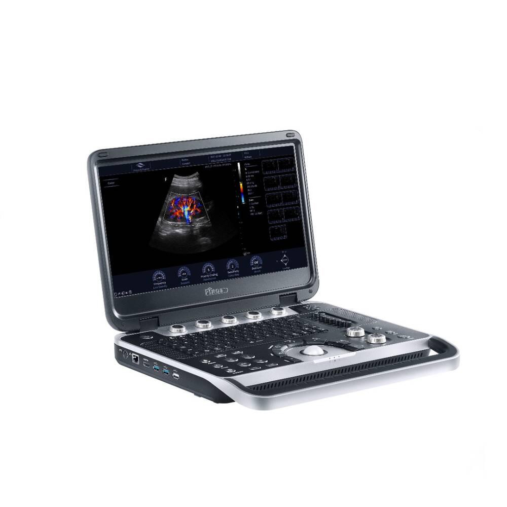 Ультразвукова діагностична система портативна Finus 45 Focus&Fusion Дніпро - фото 1