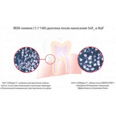 Зубна паста Dr. Wild Emofluor Daily Care зі стабілізованим фторидом олова 75 мл (7611841701686) Вінниця