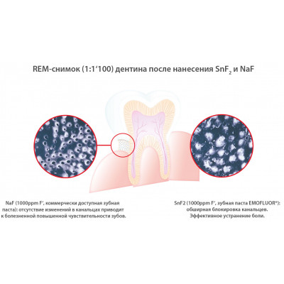 Зубна паста Dr. Wild Emofluor Daily Care зі стабілізованим фторидом олова 75 мл (7611841701686) Вінниця - фото 4