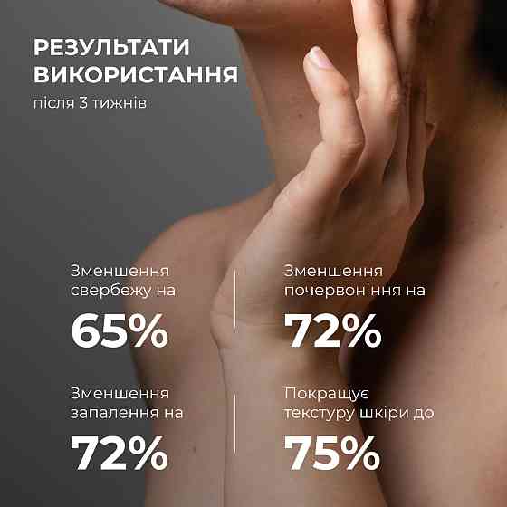 Лосьйон-детокс для проблемної шкіри з саліциловою кислотою Anti-Acne Salicylic Body Lotion Hillary 150 мл Вінниця