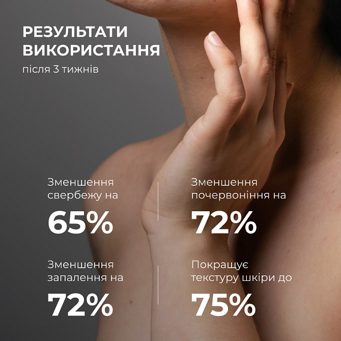 Лосьйон-детокс для проблемної шкіри з саліциловою кислотою Anti-Acne Salicylic Body Lotion Hillary 150 мл Вінниця - фото 6