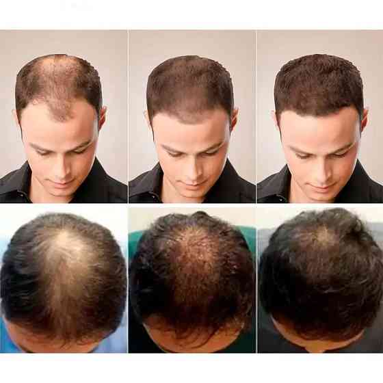 Олія для росту волосся 35мол LUNOON SBR Київ