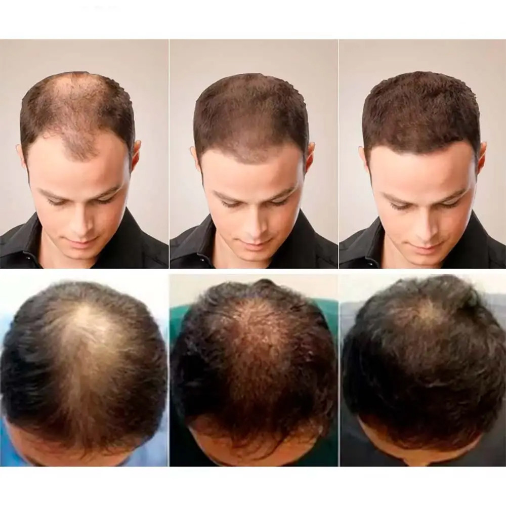 Масло для роста волос 35мл LUNOON SBR Киев - изображение 2