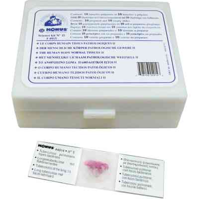 Набор микропрепаратов Konus Патологічні тканини людського тіла, частина II 10 шт (4915) Винница