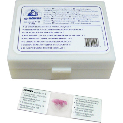 Набор микропрепаратов Konus Патологічні тканини людського тіла, частина II 10 шт (4915) Винница - изображение 1