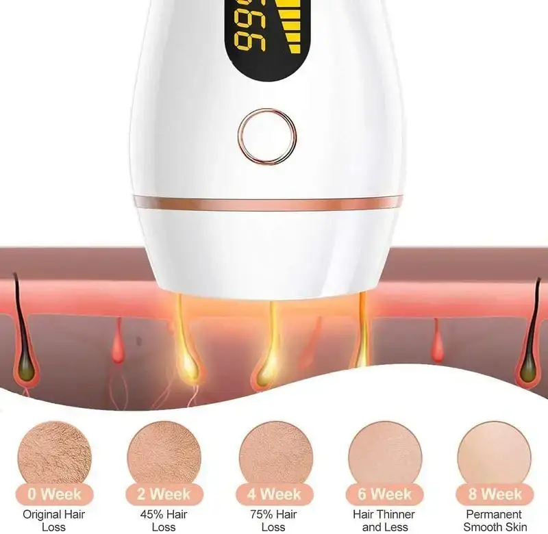 Устройство для удаления волос эпилятор Фотоэпилятор ZumYu IPL Hair Removal с ЖК-дисплеем (999 999 вспышек) Б/У Киев - изображение 3