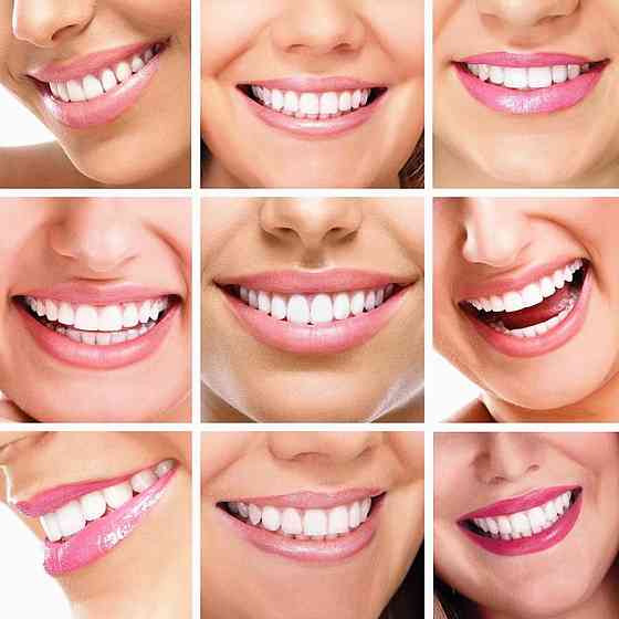 Система отбеливания зубов на батарейках,Dental White SBR Киев