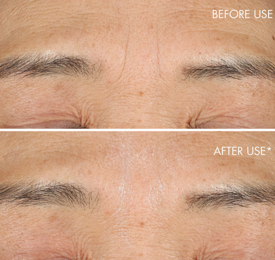 Корректор морщин Dior Capture Totale Hyalushot Wrinkle Corrector 15ml Славянск