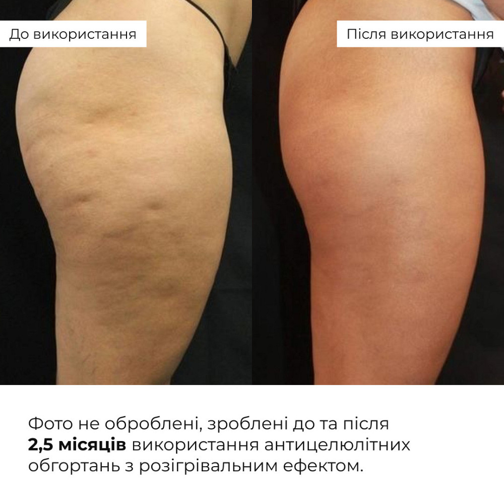 Антицелюлітні обгортання з розігрівальним ефектом Hillary Anti-cellulite Bandage Warming Effect Київ - фото 14