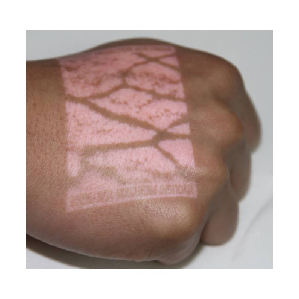 Трансиллюминатор для венозной пункции безконтактный. Модель V800F Днепр - изображение 4