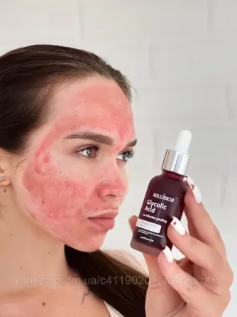 Кислотна сироватка-пілінг для обличчя HOLLYSKIN Glycolic Acid 30 мл Чернівці