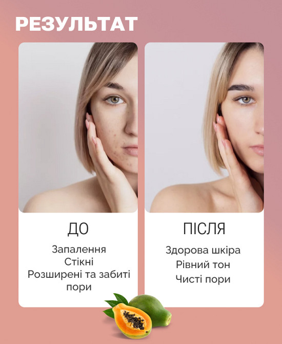Энзимная пудра с ниацинамидом для лица и тела Reclaire cosmetics 40 г Киев - изображение 3