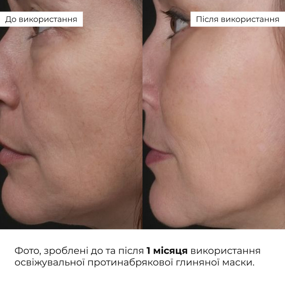 Освежающая противоотечная глиняная маска Revive & Refresh Clay Mask Hillary 90 мл Киев - изображение 18