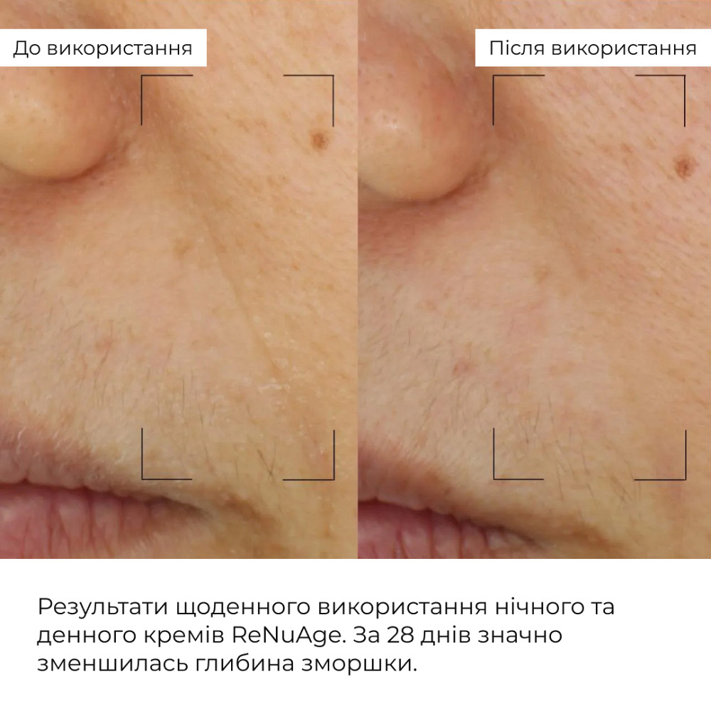 Набор коллагеностимулирующих антивозрастных кремов ReNuAge Collagen-Boosting Anti-Aging Cream Set Hillary Киев - изображение 9