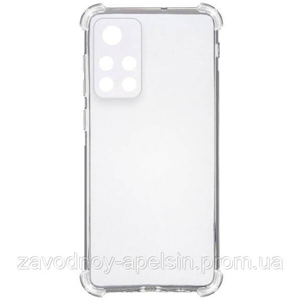 Xiaomi Poco M4 Pro 5G Прозорий чохол (Захист камери + вугли) Одеса - фото 2