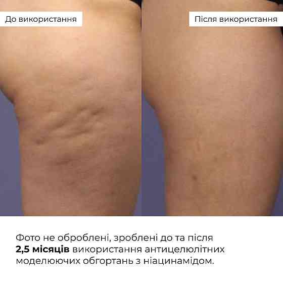 Антицеллюлитные моделирующие обертывания для тела с ниацинамидом Niacinamide Cold Slim Hillary Винница
