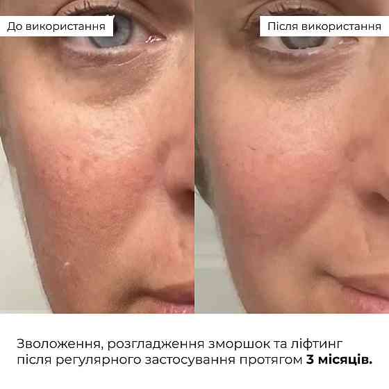 Антивозрастной ежедневный уход за лицом Hillary Daily Anti-Aging Care Киев