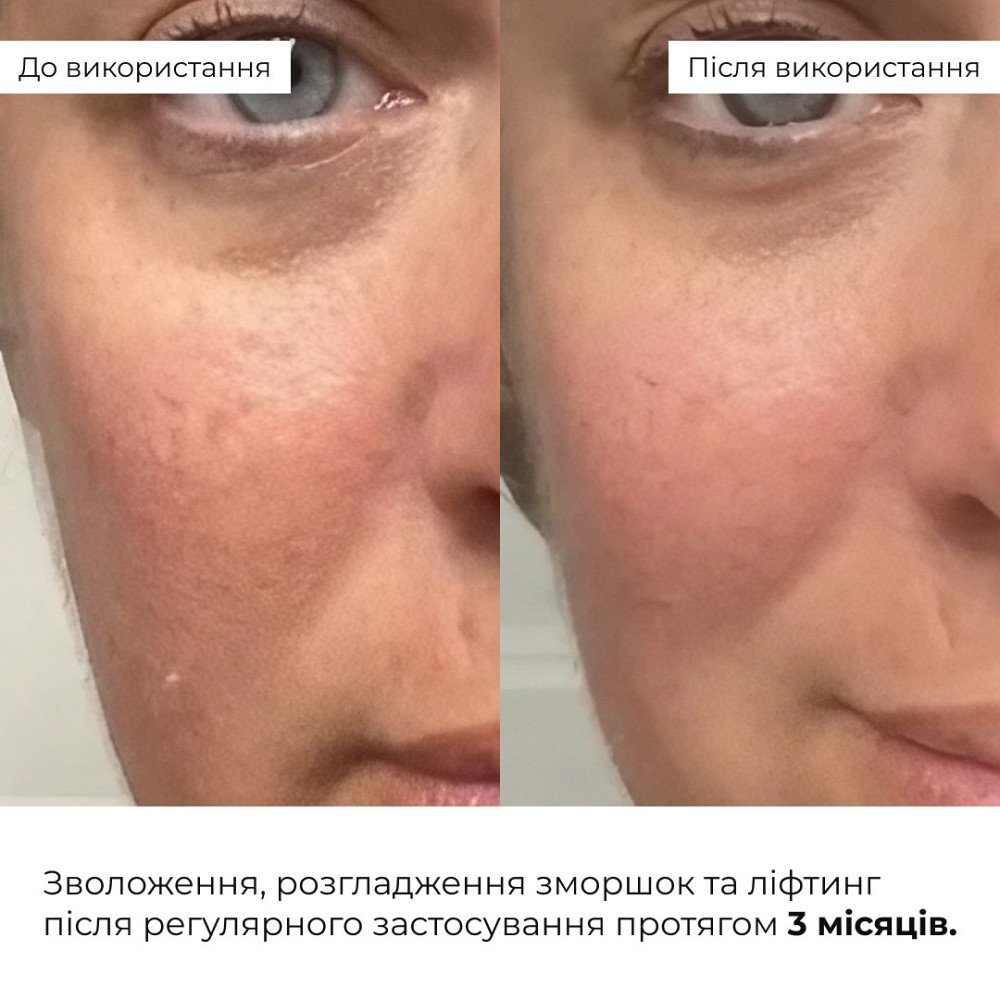 Антивозрастной ежедневный уход за лицом Hillary Daily Anti-Aging Care Киев - изображение 2