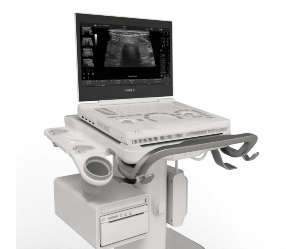 Портативний ультразвуковий апарат (УЗД) LOGIQ™ e Дніпро - фото 2