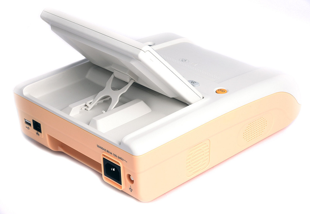 Монітор фетальний BF500E Дніпро - фото 3