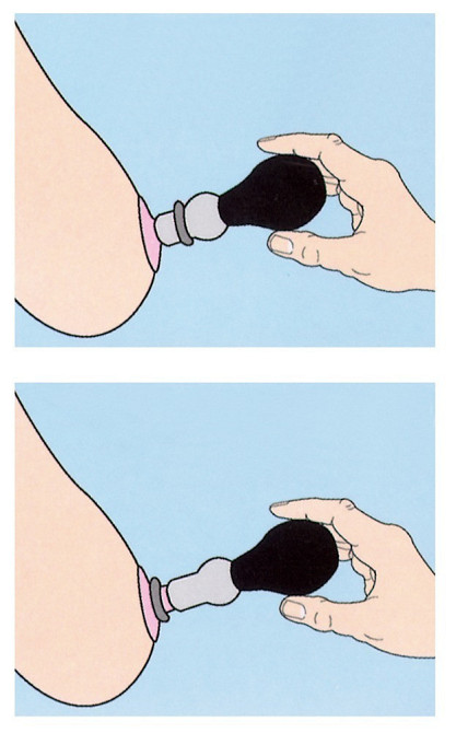 Вакуумна помпа - Nipple Pump Sex Aura Київ - фото 3