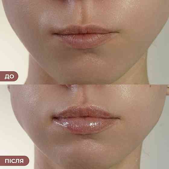 Набор блесков для объема и увлажнения для губ Hillary Lip Volume & Hydration Gloss Set Киев