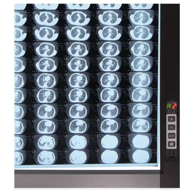 Світлодіодний медичний негатоскоп WL-2D Дніпро - фото 4