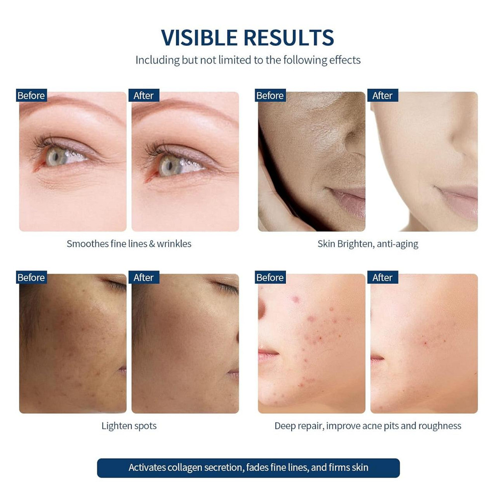 Беспроводная LED-маска для лица, 7 цветов, антивозрастной уход, омоложение, осветление кожи, 270 LED Киев - изображение 4